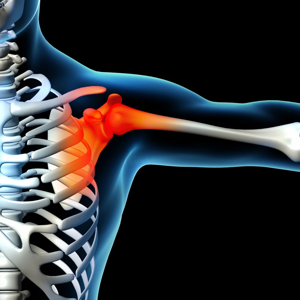 Musculoskeletal Sports Injury