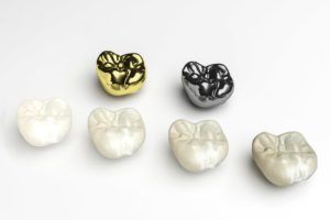 types of dental crowns