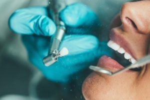 Dental instruments around a patients mouth