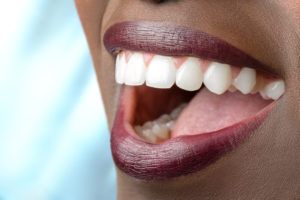 woman smiling with white teeth