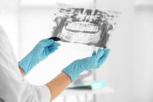 Hands with gloves holding a dental xray