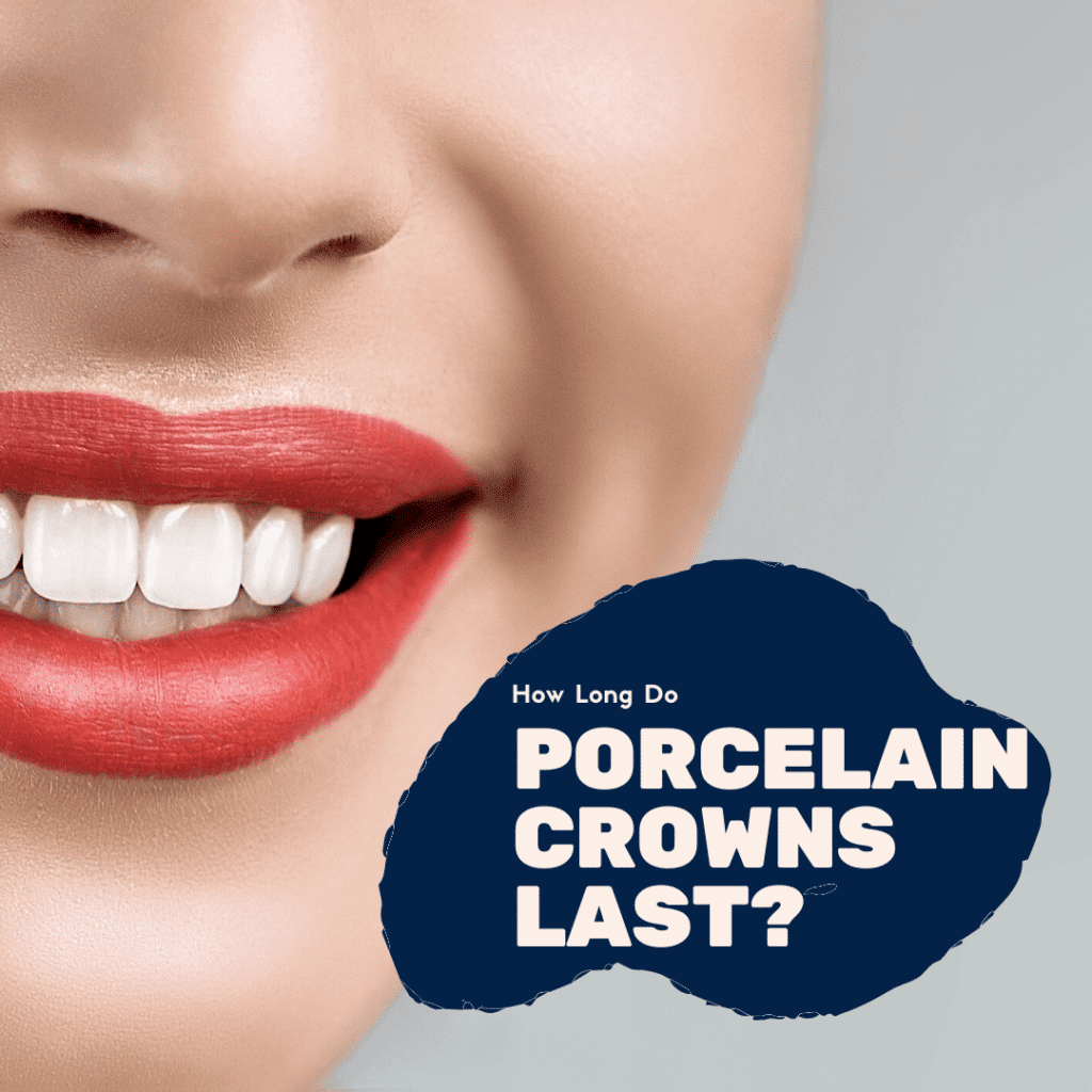 How Long Do Porcelain Crowns Last?