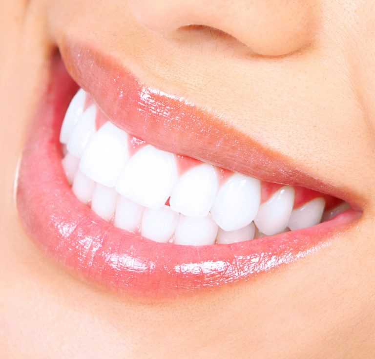 Teeth Whitening Near Me